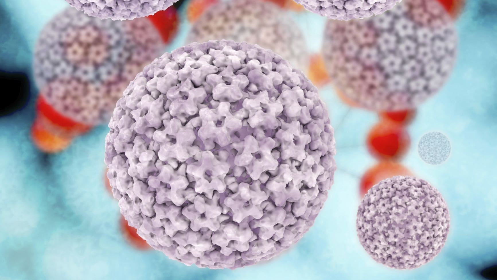 Tratamiento de condilomas en Guadalajara